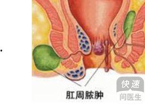 欧美肛门注射视频直播